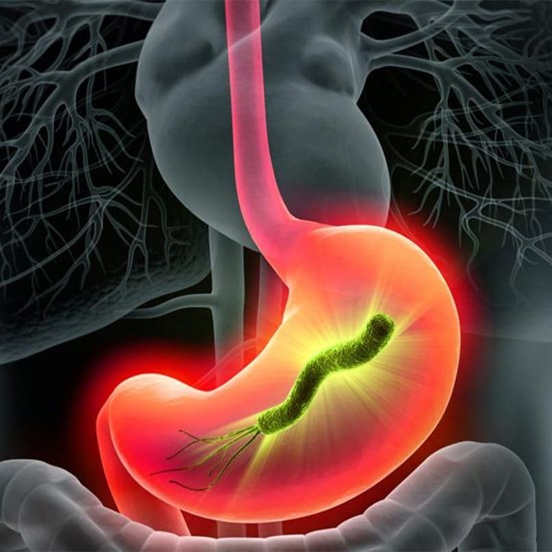 h pylori screening doctors in Chandigarh